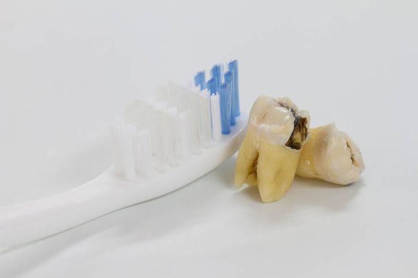 Tooth decay dental caries and tooth brush - Photo, Image