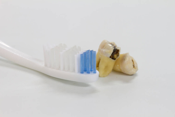 Zubní kaz zubní kaz a zubní kartáček - Fotografie, Obrázek