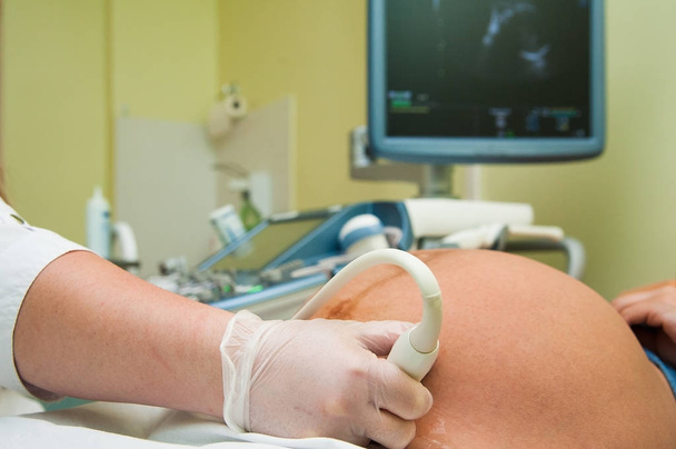 Врач с помощью ультразвукового оборудования проводит скрининг беременной женщины
. - Фото, изображение