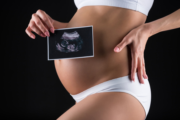 pregnant woman with ultrasound scan - Fotó, kép