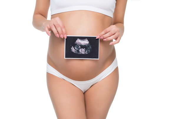 pregnant woman with ultrasound scan - Fotografie, Obrázek