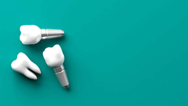 Teeth isolated on green background. 3d illustration - Photo, Image
