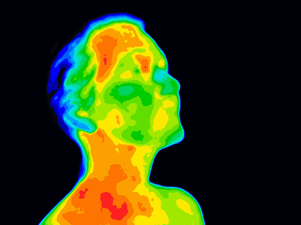 Face Thermograpy Carotid - Photo, Image