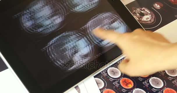 4k doctor study Mri Scanner on ipad,head & organ pet-ct. - Footage, Video