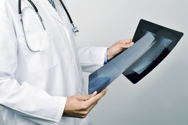 lekarz obserwując niektóre zdjęcia rentgenowskie - Zdjęcie, obraz
