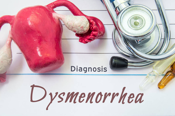 Diagnoosi dysmenorrea. Potilaan sairaushistoria, jolla on diagnosoitu dysmenorrea kirjoitus seuraava stetoskooppi, kohtu, jossa on munasarjat, ampulli lääkkeellä. Hoito ja diagnostinen käsite
 - Valokuva, kuva