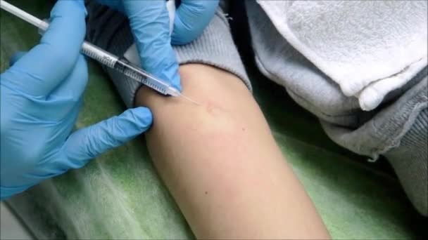 Hautarzt führt Lokalanästhesie am Arm durch - Filmmaterial, Video