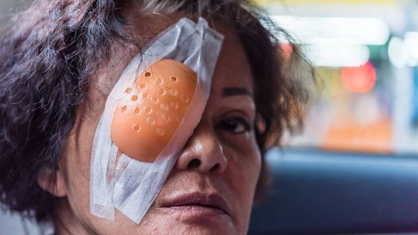 Potilas aasialainen naiset osoittavat hänen silmänsä silmäsuojuksella
 - Valokuva, kuva