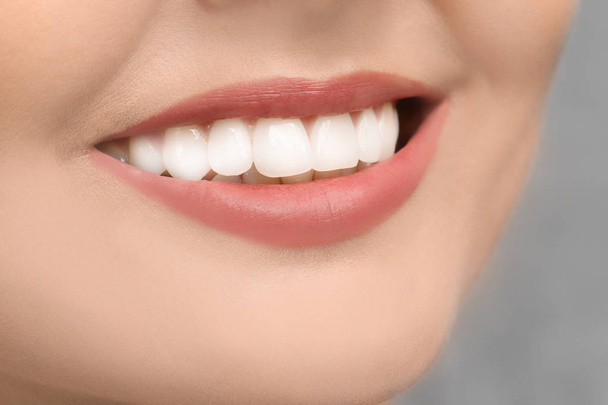 Young woman with healthy teeth  - Фото, изображение
