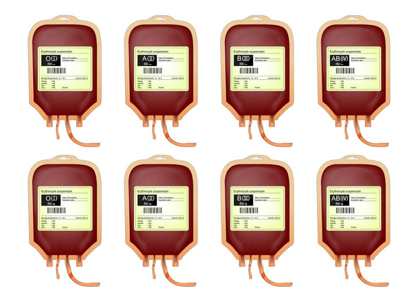 a transfusion of donor blood. - Vector, Image