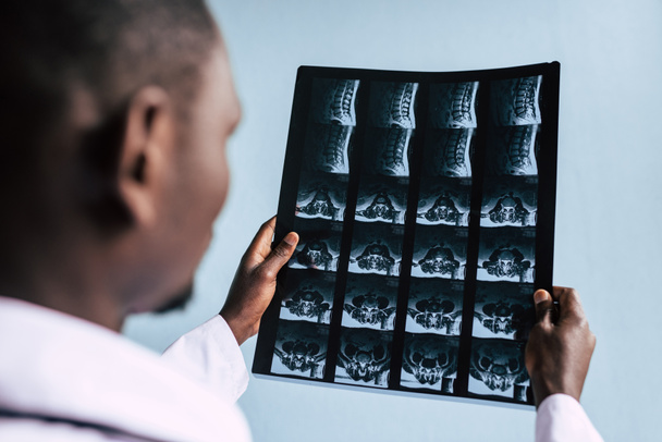 x 線写真とアフリカ系アメリカ人の医者 - 写真・画像