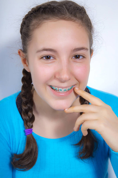 Lächelndes Teenager-Mädchen mit Zahnspange - Foto, Bild