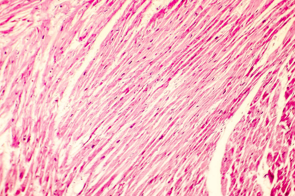 Kalp hipertrofisi photomicrograph - Fotoğraf, Görsel