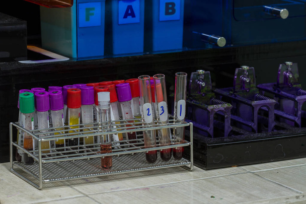 test de dépistage de Mycobacterium tuberculosis par des experts en génomique des expectorations
 - Photo, image