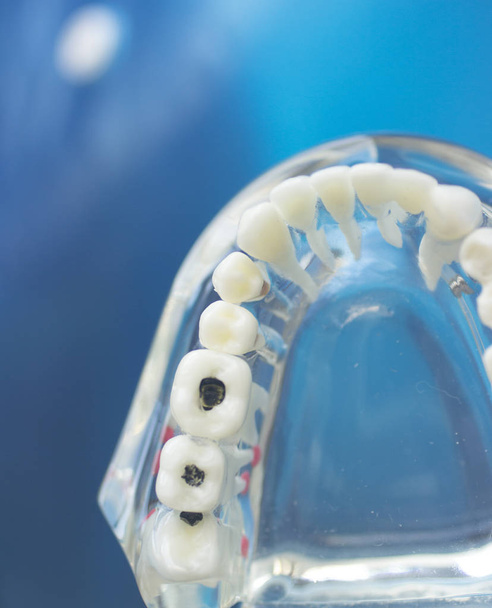 Dental teeth mouth model - Valokuva, kuva