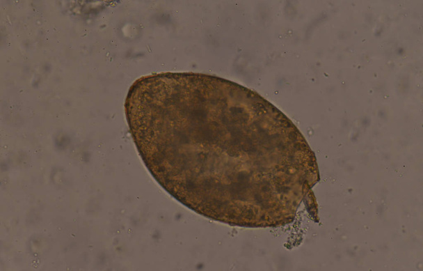 Big size Fasciola parasite egg. - Photo, Image
