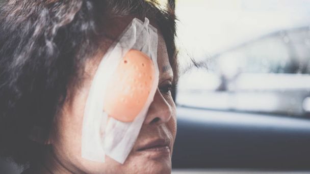Patiënt Aziatische vrouwen tonen haar ogen met oog schild - Foto, afbeelding