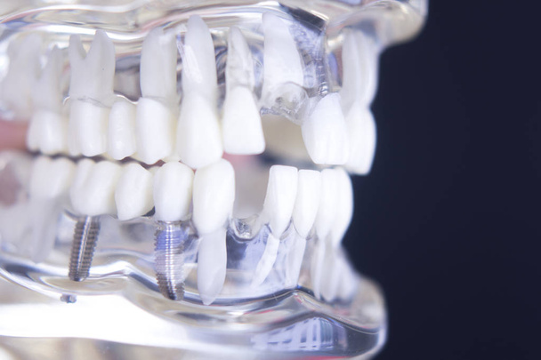 Dentsts dental tanden model - Foto, afbeelding