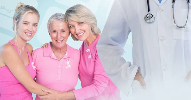 Breast cancer doctor and women  - Fotoğraf, Görsel
