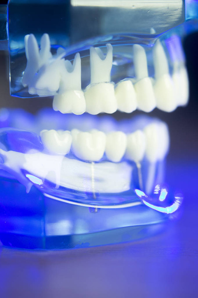 Modelo clínico de dientes dentales
 - Foto, Imagen