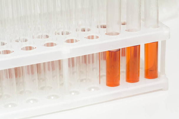 Tubos de ensayo de vidrio de laboratorio llenos de líquido naranja para un experimento en un laboratorio de investigación científica
 - Foto, Imagen