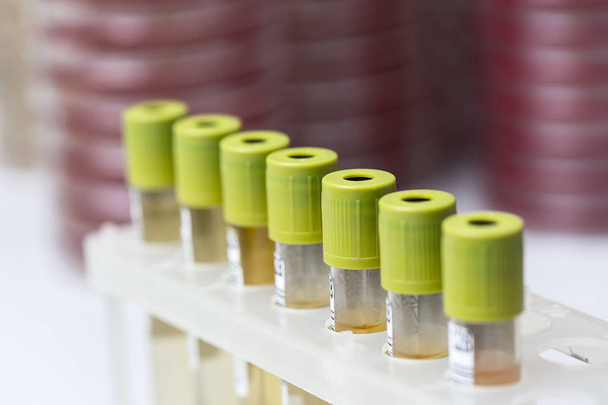Tubos de ensaio com líquido amarelo em laboratório
 - Foto, Imagem