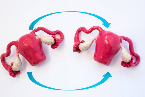 Uterus transplantation concept photo. Two anatomical models of uterus with ovaries with two arrows crossing over each other, symbolizing transplantation of human organs of female reproductive system - Photo, Image