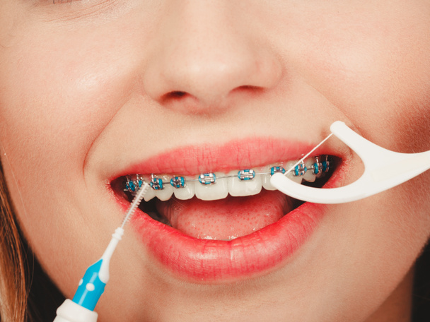 Γυναίκα χαμογελαστά δόντια καθαρισμού με τιράντες - Φωτογραφία, εικόνα