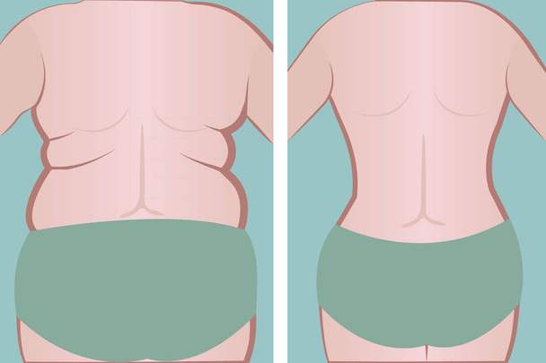 Fat and slim girl's back.  vector - Vector, Image