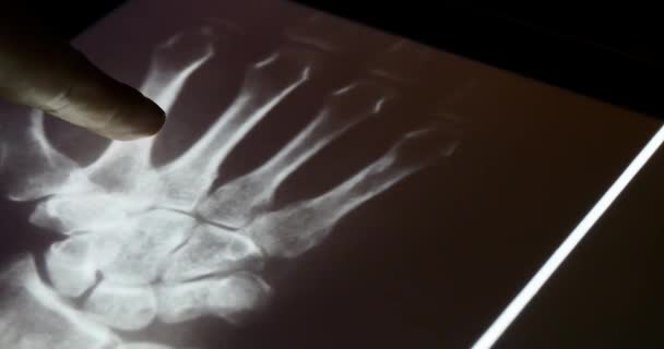 4k doctor touch pet-ct Röntgenfilm auf Touchscreen ipad App Software zur Analyse - Filmmaterial, Video