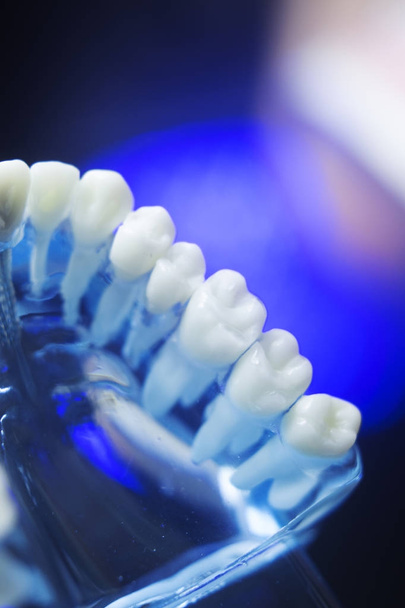 Dental teeth decay model - Photo, Image