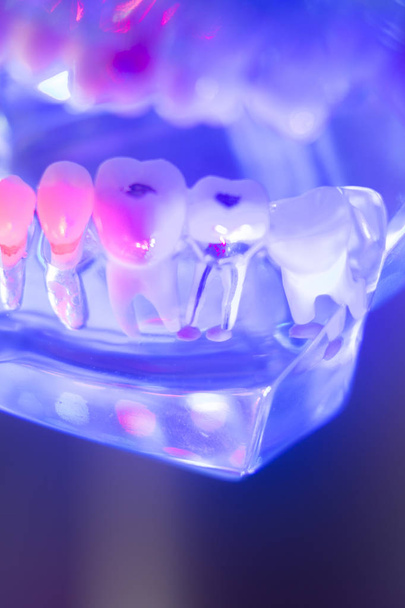 Dental modelo de dentes saudáveis
 - Foto, Imagem