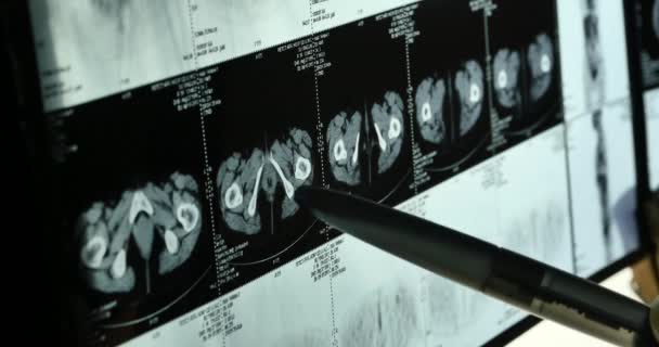 4 k 医師研究頭蓋骨脳 analysis.health 病院用 x 線フィルム. - 映像、動画