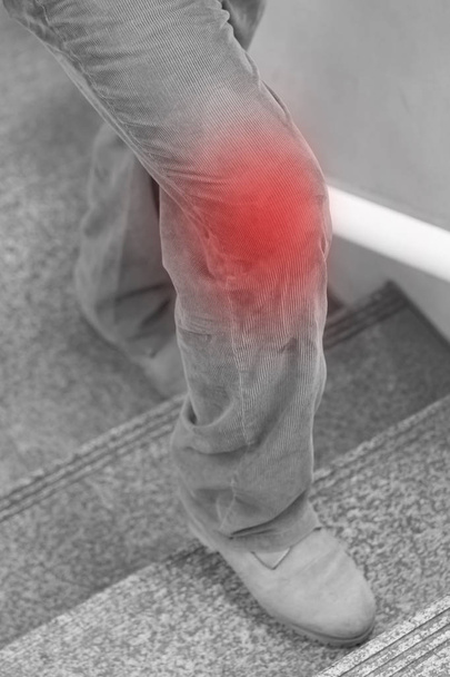 Концепция боли в коленном суставе, нога поднимается по лестнице
 - Фото, изображение