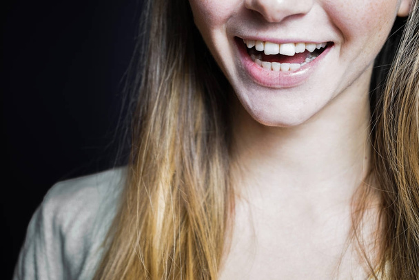smiling laughing girl showing her teeth on a black background - Φωτογραφία, εικόνα