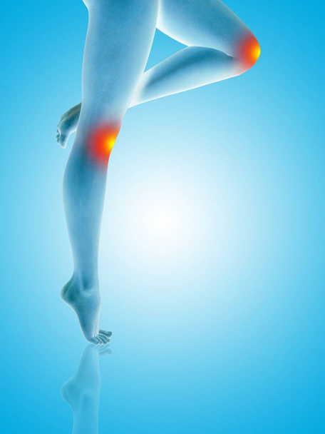 Conceptual illustration of leg ache - Photo, Image