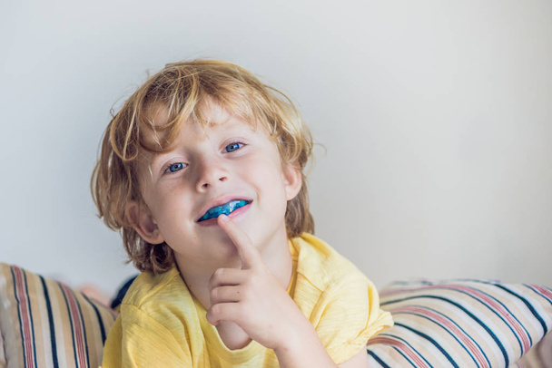 Three-year old boy shows myofunctional trainer to illuminate mouth breathing habit. Helps equalize the growing teeth and correct bite. Corrects the position of the tongue - Foto, afbeelding