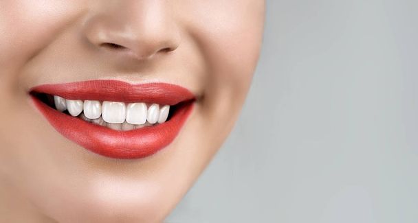  young woman  with whitening teeth - Foto, afbeelding