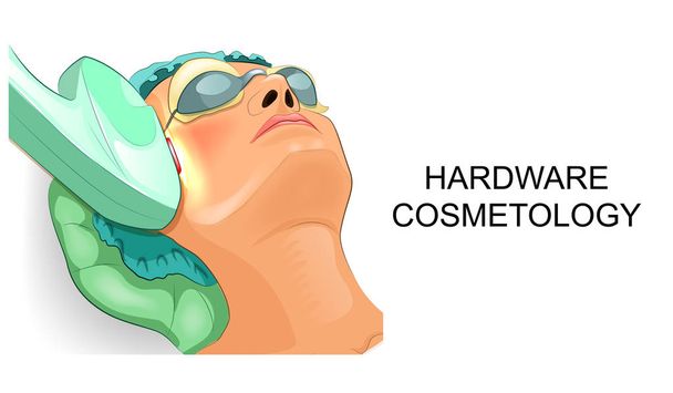 the woman's face during machine cosmetology - Vector, Image
