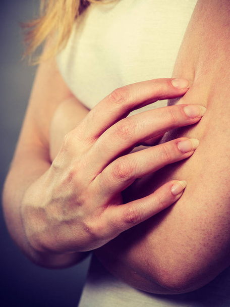 женщина чешет свою зудящую руку аллергической сыпью
 - Фото, изображение
