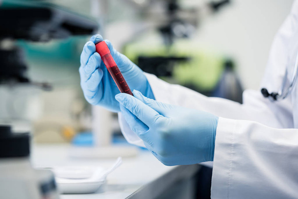 Cientista em laboratório biológico segurando teste de sangue na mão
 - Foto, Imagem
