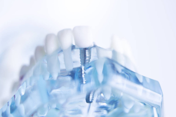 Dentstas modelo de dentes dentários
 - Foto, Imagem