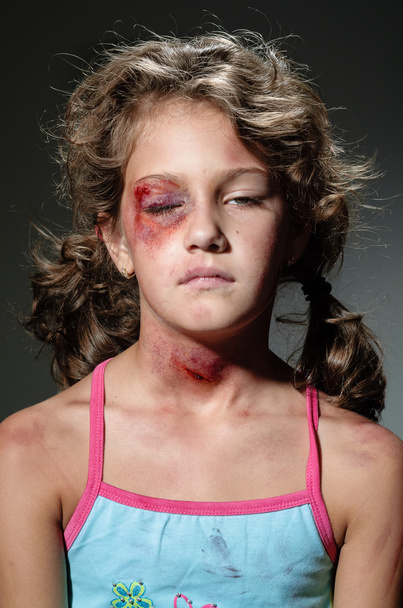 Injured child - Foto, imagen