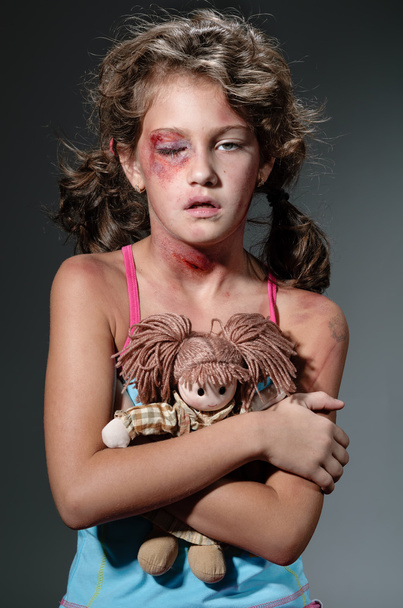 τραυματίες παιδί - Φωτογραφία, εικόνα