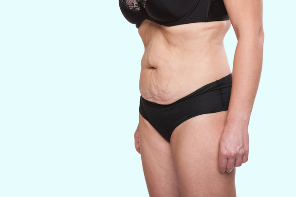 Woman with saggy belly - Zdjęcie, obraz