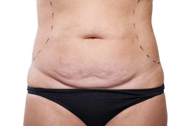 Female saggy belly - Zdjęcie, obraz