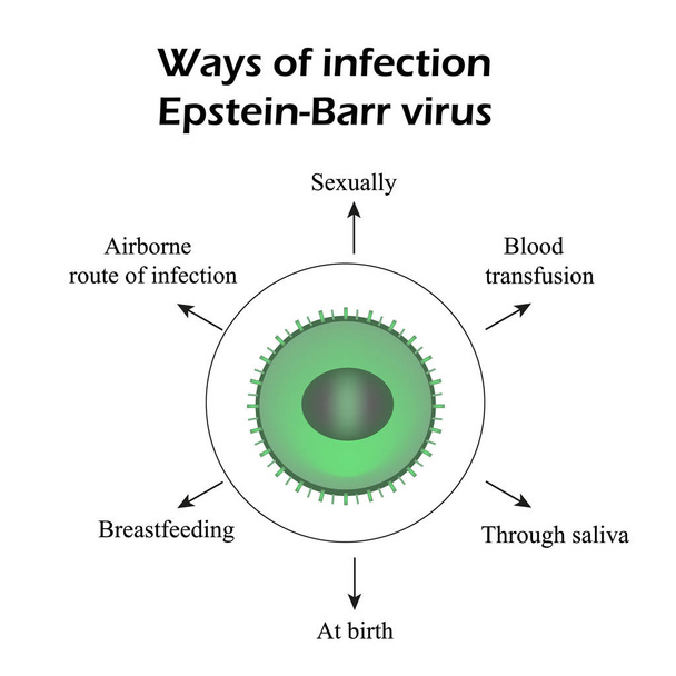 Epstein-Barr virus. Methods of infection. Infographics. Vector illustration - Vector, Image