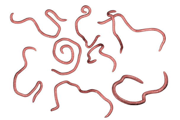 Bélférgeket fonálférgek Enterobius - Fotó, kép
