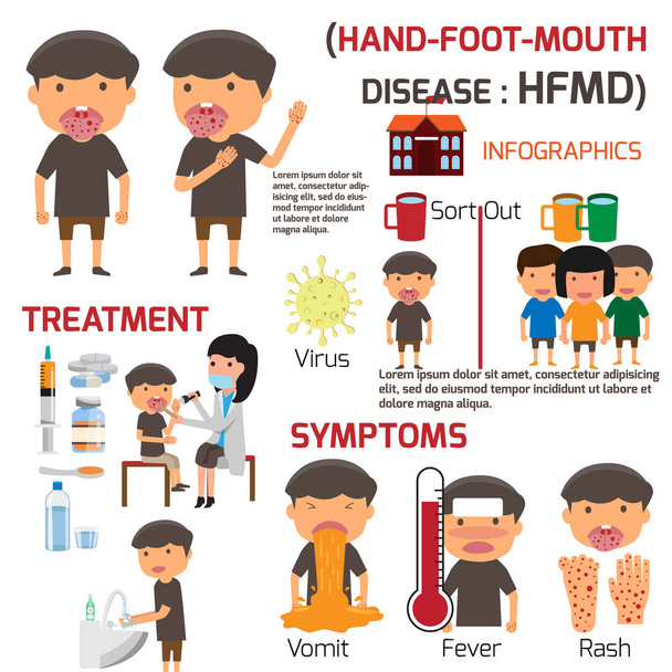 Enfants atteints de fièvre aphteuse. Affiche détaillée de Maladie main-pied-bouche
 - Vecteur, image