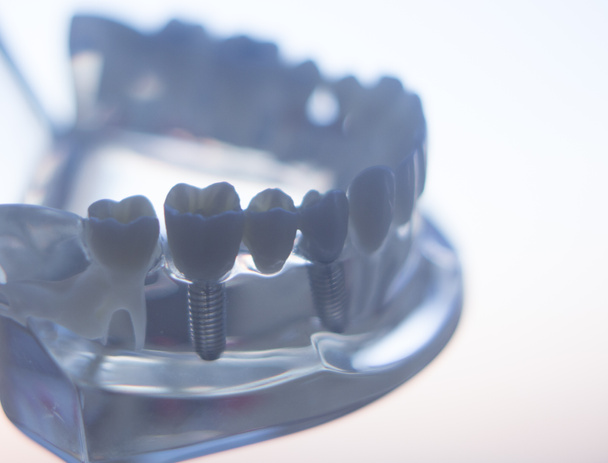 Модель рота зубів зубів
 - Фото, зображення